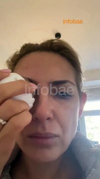 El video de Fabiola Yañez donde mostró los golpes en la denuncia contra Alberto Fernández