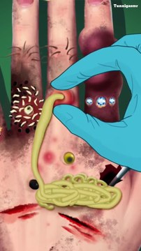Hand Maggots Warms Animation asmr Treatment Clean Removing Pus and Care #asmr #asmrvideo #animation