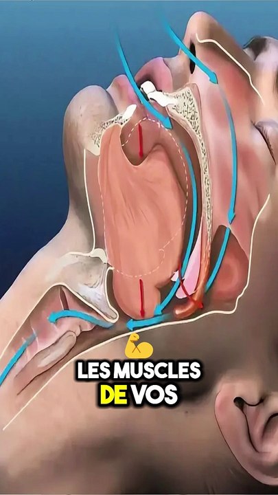 Stop au ronflement, 3 astuces pour ne plus ronfler #stopauronflement #ronflement #astuce #neplusronfler #ronfler #mieuxdormir