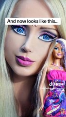 people who get 20+ surgeries