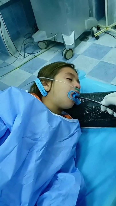 Endoscopy for coine removel  التنظير لإزالة العملة सिक्का हटाने के लिए एंडोस्कोपी #viral#shorts#short#DrSadia1446