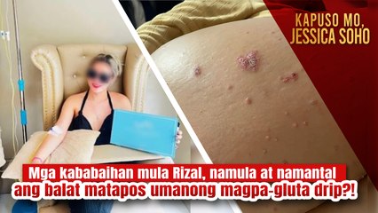 Mga Kababaihang Nasira ang Balat Matapos Magpa-Gluta Drip sa Rizal 😱 | Kapuso Mo, Jessica Soho