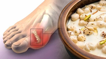 Makhana For Uric Acid: High Uric Acid Me Makhana Khana Chahiye Ya Nahi...|Boldsky