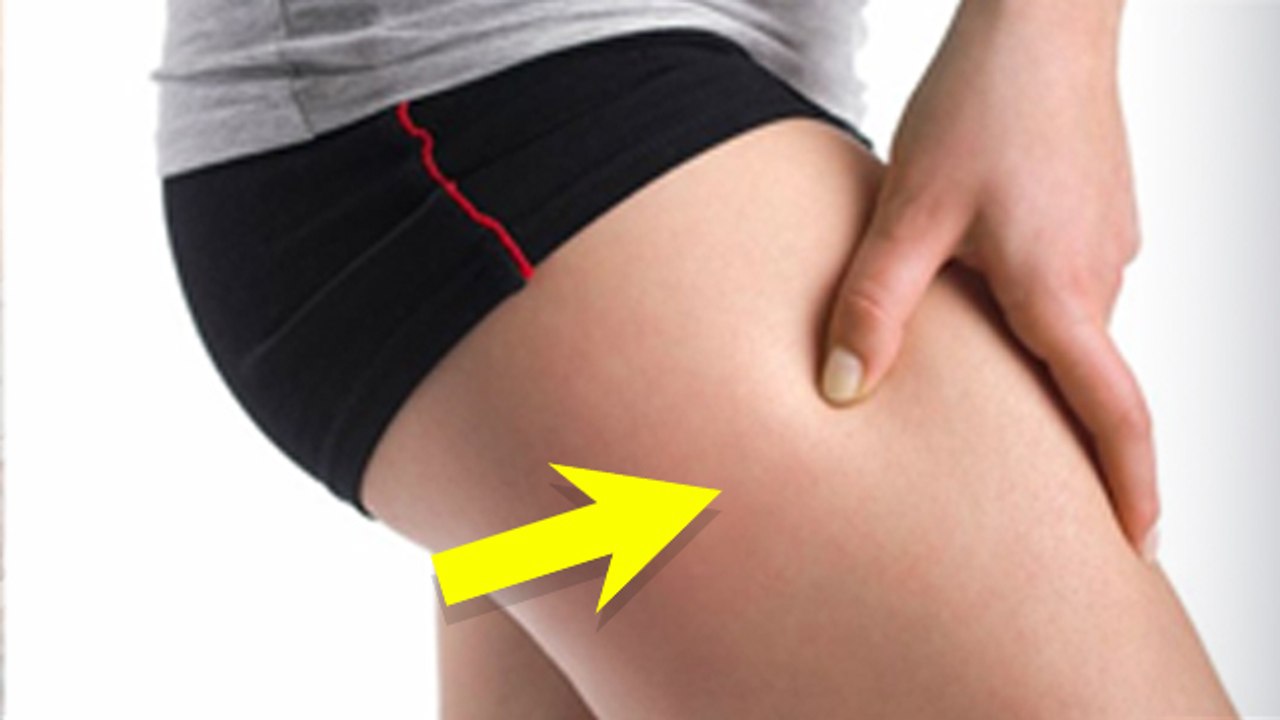 Meralgia Paresthetica Causes & Treatment: Thigh Me Jhanjhanahat Reason In Hindi
