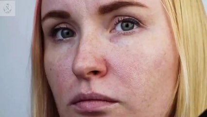 وصفة طبيعية للمسامات الواسعة | التخلص من مسامات الوجه #العودة_للطبيعة #المسامات_الواسعة #بشرة_موحدة