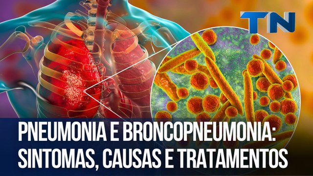 Pneumonia e broncopneumonia: sintomas, causas e tratamentos | Cuide-se Bem!
