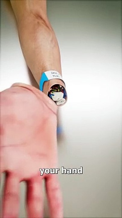 How A Hand Transplant Works ✋ #science #sciencefacts #facts #factsdaily #factsoflife #fy #fypシ #fypシ゚viralシ2024fyp #fypシ゚vira