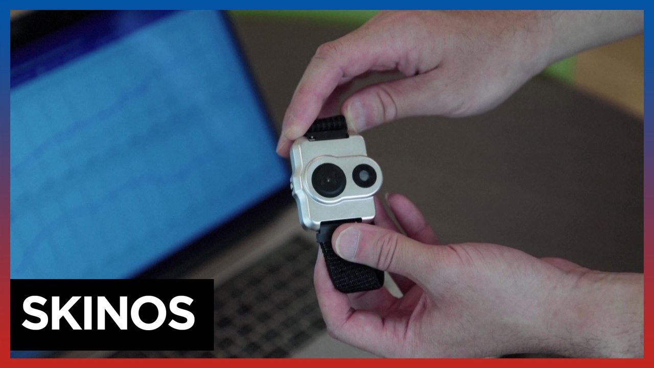 Beating heat with sweat-detecting smartwatch