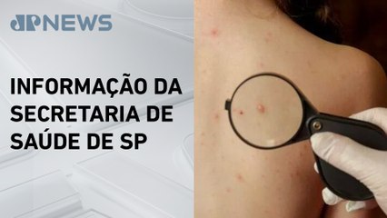Homem com suspeita de Mpox testa positivo para catapora