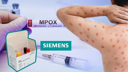 Mpox की जांच के लिए भारत ने बना ली पहली स्वदेशी किट, जानें कैसे होगी जांच