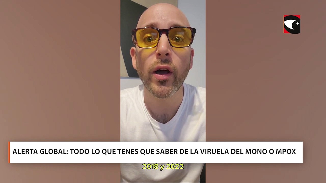 Alerta global: Todo lo que tenes que saber de la viruela del mono o mpox