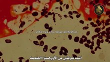 هذه السيدة شرحت قانون الجذب بطريقة مثالية - اجذب أي شيء تريده الآن