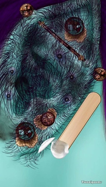 Makeover Tile ASMR: Precious one ear Cleaner Theropy Satisfying Remove Hair-Dirt #asmrvideo #asmr