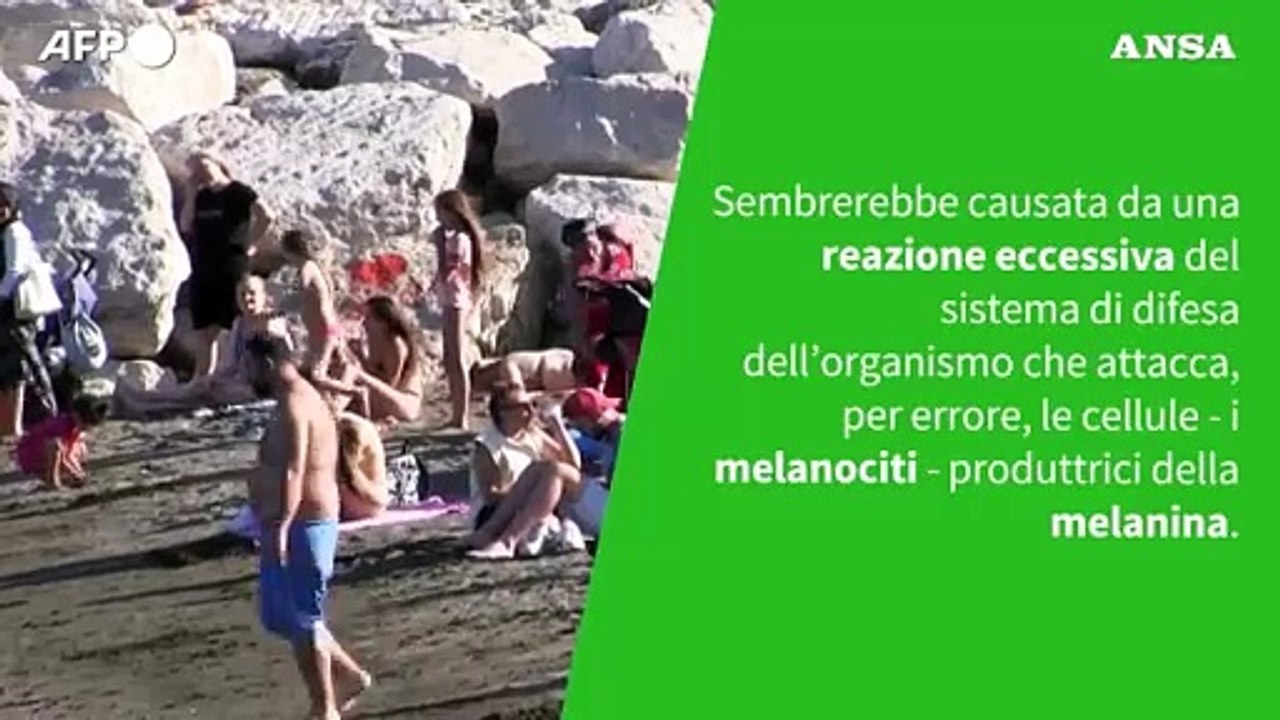 Ansa VERIFIED - Con la vitiligine si puo' prendere il sole?