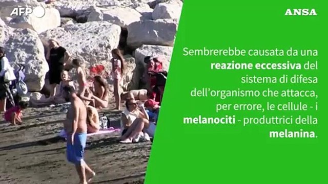 Ansa VERIFIED - Con la vitiligine si puo' prendere il sole?