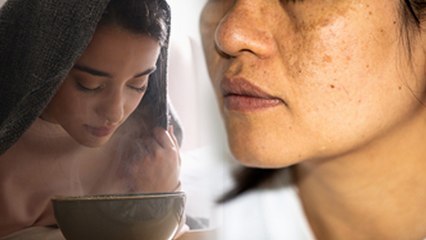 Facial Steam Side Effects: Is Steam Good For Dry & Sensitive Skin, Cause Melasma...