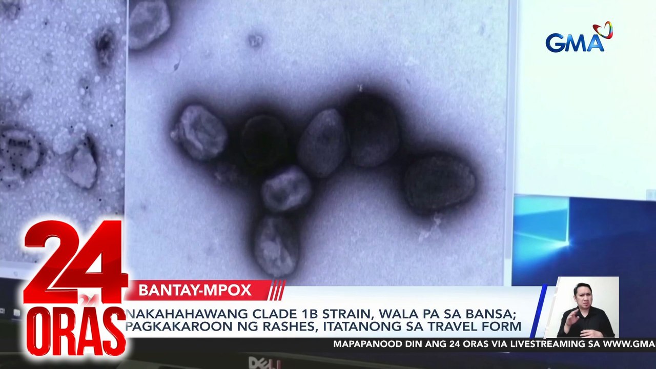 Nakahahawang Clade 1B strain, wala pa sa bansa; pagkakaroon ng rashes, itatanong sa travel form | 24 Oras