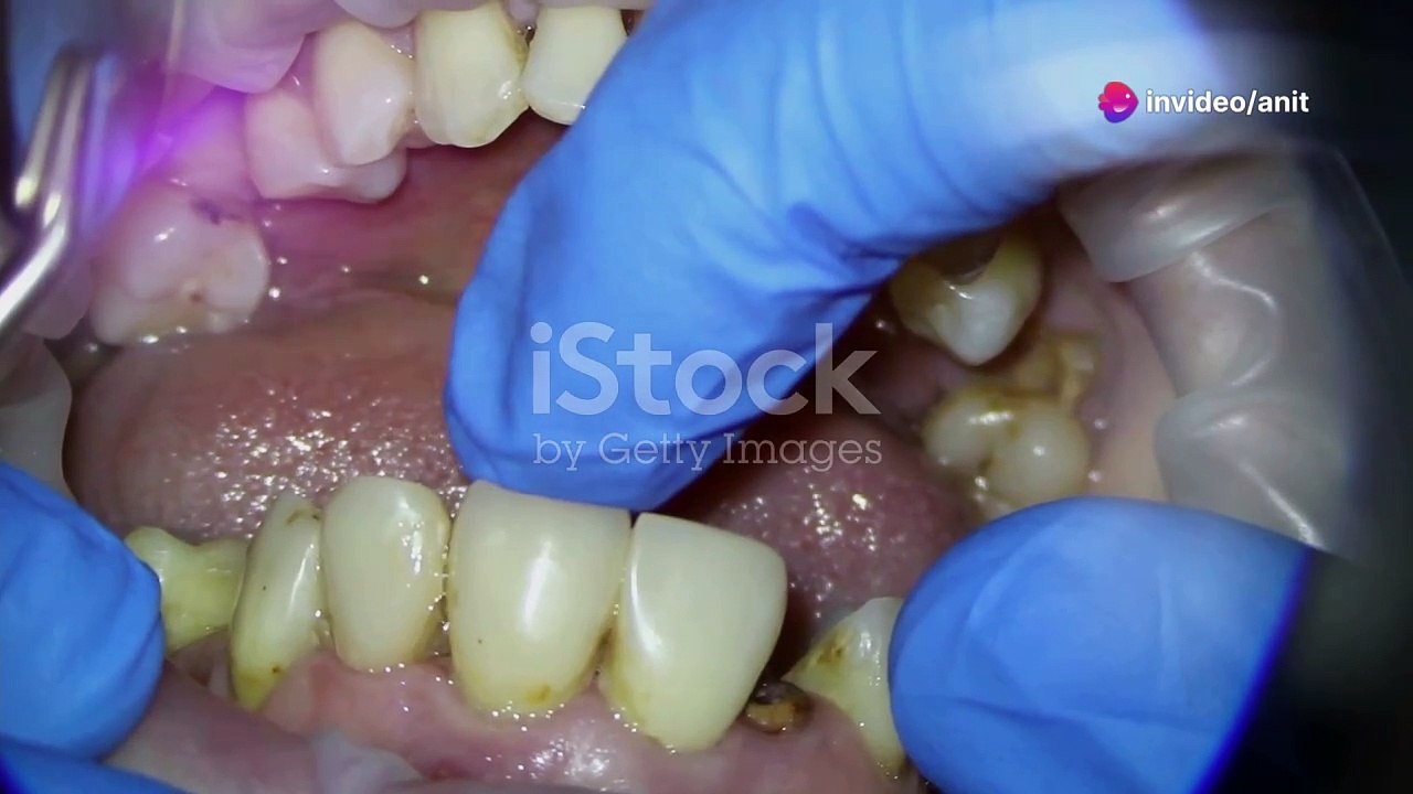 Link Between Oral Health and Physical Well-being | Dentist in Derry, NH