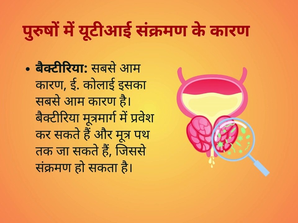 urinary tract infections in males, पुरुषों में यूटीआई के लक्षण, पुरुषों में यूटीआई के कारण, इलाज,