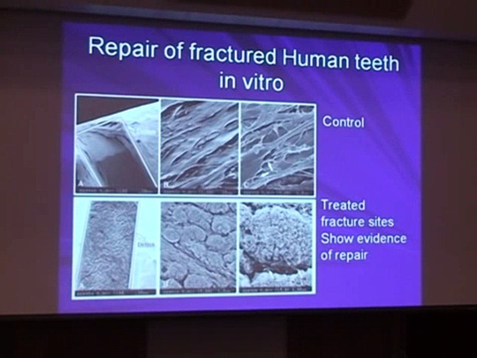Part 2 Riparazione base dentale tramite ultrasuoni