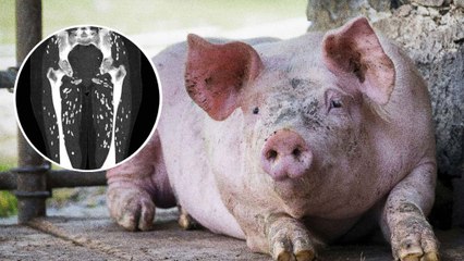 عدوى طفيلية خطيرة بسبب لحم الخنزير