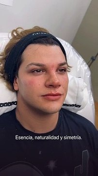 Impresionante: Emma, de Gran Hermano, mostró los retoques que de hizo en su cara