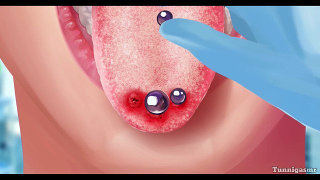 Clinic Dash: Toung Rings Infection Treatment Operating Asmr #asmrvideo #asmr #trend #animation #dailymotion