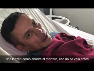 GNB quemados por la violencia opositora