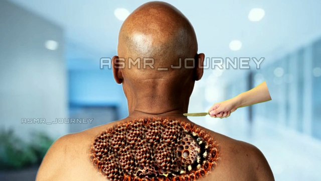 Old Men Back ASMR Animation| Maggots and Dogticks Removal Treatment | #asmr #relaxing