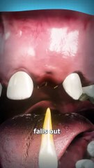 How Adult Teeth Grow In  #Viral #Viralvideo #USA #Canada #Trending #TrendingVideo #Famous #FamousVideo