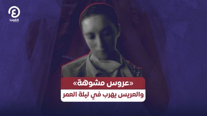 «عروس مشوهة» والعريس يهرب في ليلة العمر
