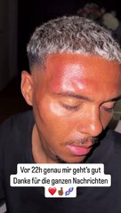 Niklas-Wilson Sommer Profile