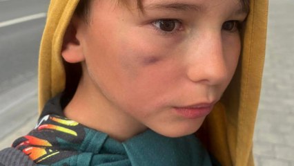 « Ils le réveillaient avec des claques » : la mère de Jean, couvert de bleus en colonie de vacances, raconte son « calvaire »