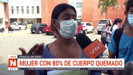 mujer con 80% de cuerpo quemado