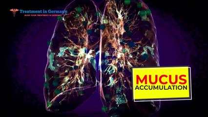 Understanding and Managing Bronchiectasis