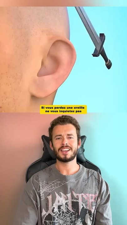 Si vous perdez une oreille ne vous inquiétez pas 