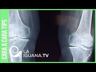 “Es el mejor momento para estar lesionada”: El camino de Stefany Hernández rumbo a Tokio 2021