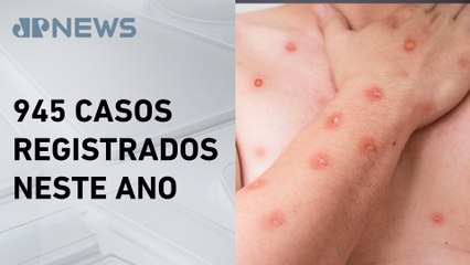 Brasil registra mais casos de Mpox em 2024 do que em 2023