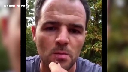 Doğal botoks etkisi yaratmak için dudaklarına arı iğnesini batırdığı anlar şaşırttı