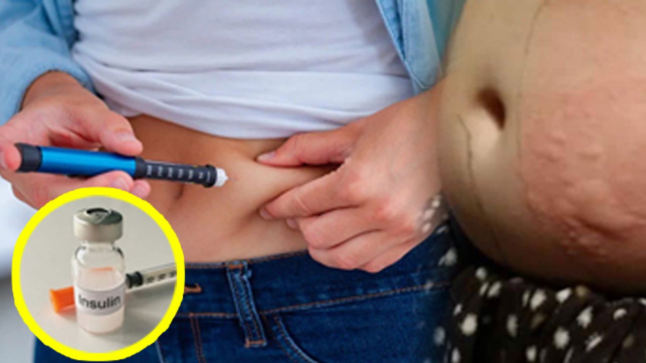 Jyada Insulin Lene Ke Nuksan| Is Too Much Insulin Bad For Diabetes Patients |Boldsky