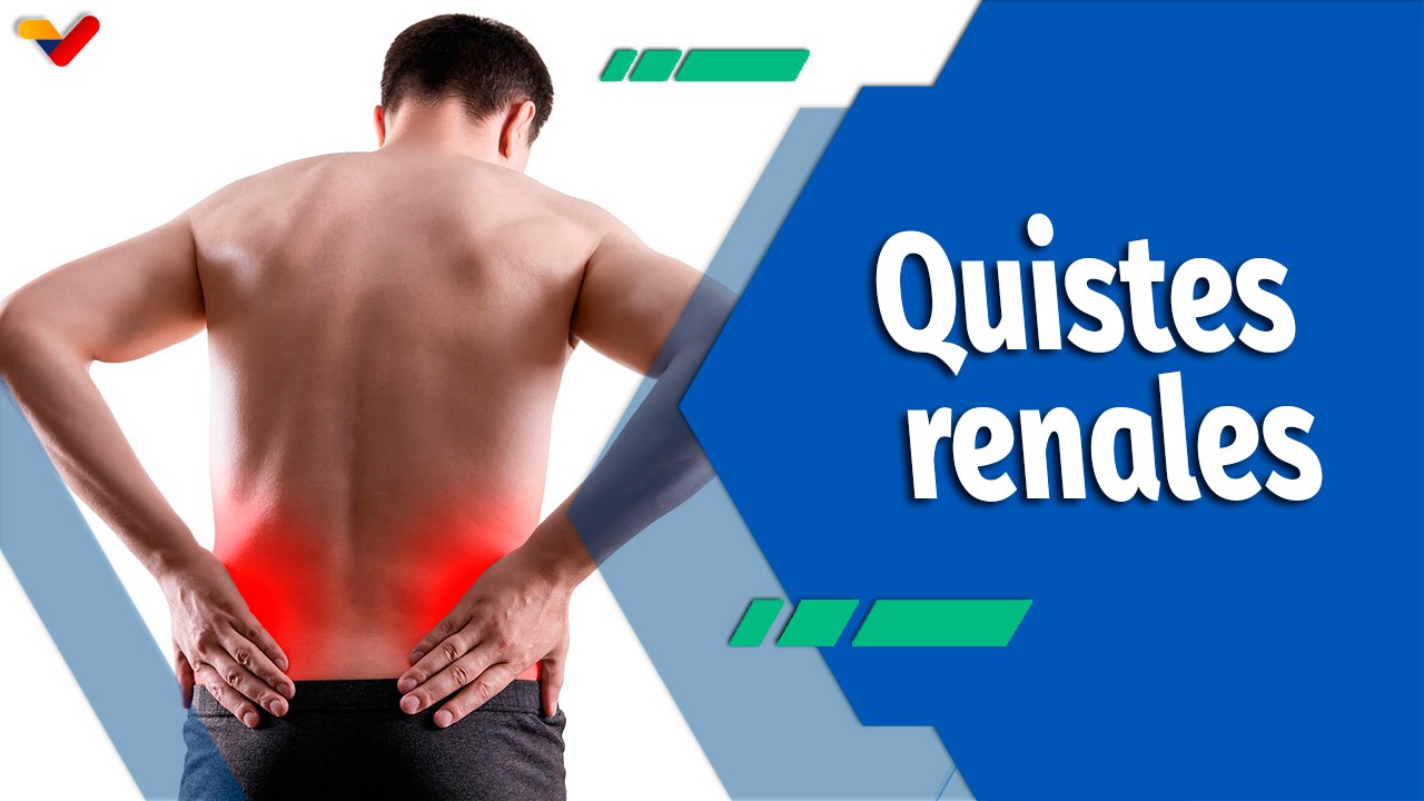 Actitud Saludable | Descubriendo los quistes renales: Causas, síntomas y tratamiento