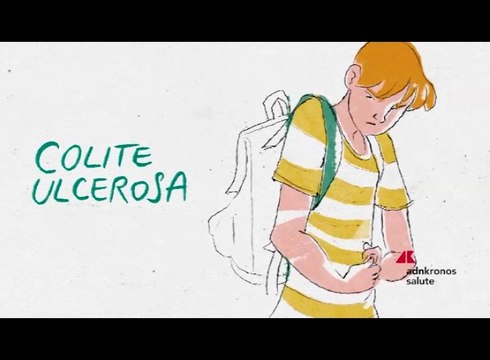 Lilly, l’Aifa approva mirikizumab: primo farmaco di una nuova classe rimborsato per il trattamento della colite ulcerosa
