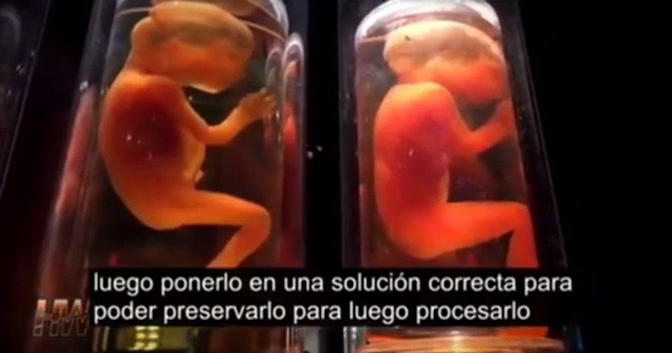 MUTILATE FETUS STILL ALIVE FOR VACCINES