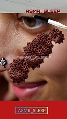 Girl face chin dot injury removal animation #asmrcleaning #cleaningvideos