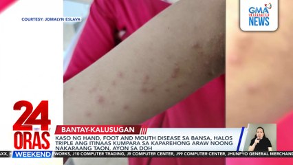 Kaso ng hand, foot and mouth disease sa bansa, halos triple ang itinaas kumpara sa kaparehong araw noong nakaraang taon, ayon sa DOH | 24 Oras Weekend