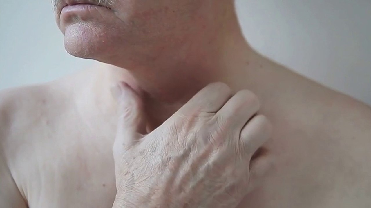 bd-como-identificar-una-alergia-270225