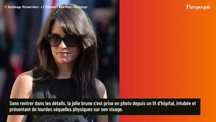 Hospitalisée et le visage défiguré, une ex-animatrice et femme d'un grand champion s'affiche méconnaissable