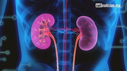 Se exponen juarenses a padecer problemas de riñón