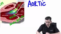 10. Aortic regurgitation