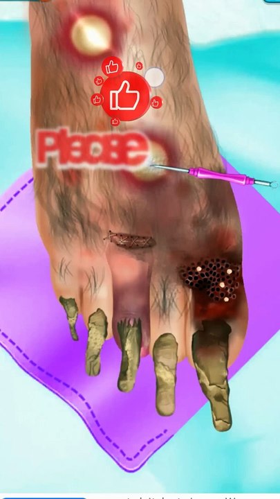 Asmr Animation trick infected foot  ASMR  Amar_asmr